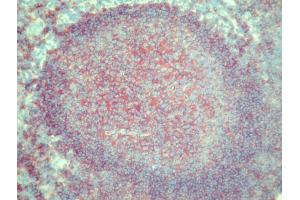 Immunohistochemistry (IHC) image for anti-MHC Class II HLA-DQ (HLA-DQ) antibody (Biotin) (ABIN452105) (HLA DQ antibody  (Biotin))