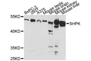 Western blot analysis of extracts of various cell lines, using SHPK antibody (ABIN5996627) at 1:3000 dilution. (SHPK antibody)