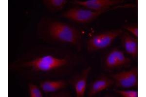 Immunofluorescent staining of methanol-fixed Hela cells using NFKB2 (phospho S870) polyclonal antibody  at 1:100-1:200 dilution. (NFKB2 antibody  (pSer870))
