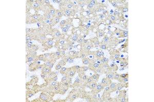 Immunohistochemistry of paraffin-embedded human liver injury using ARL6 antibody at dilution of 1:100 (x40 lens). (ARL6 antibody)