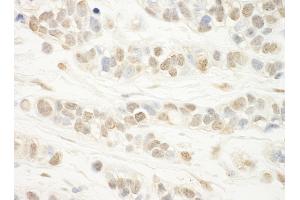 anti-WD Repeat Domain 5 (WDR5) (AA 50-100) antibody