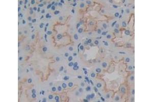 Figure. (BRP44L antibody  (AA 1-109))