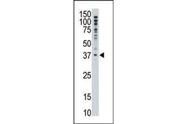 MAGEF1 antibody  (C-Term)