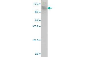 Western Blot detection against Immunogen (120. (TOP3B antibody  (AA 1-862))