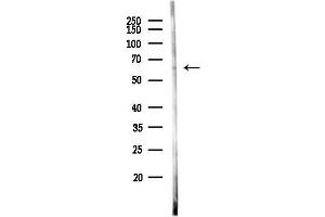 Western blot analysis of lysates from Hela cells(heat-shock 45 min treatment), using ZNF382 Antibody at 1/1000 dilution.