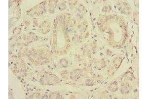 Immunohistochemistry of paraffin-embedded human salivary gland tissue using ABIN7151506 at dilution of 1:100 (SLC4A8 antibody  (AA 1-300))