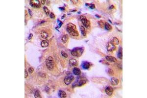 Immunohistochemistry (IHC) image for anti-Nuclear Factor of kappa Light Polypeptide Gene Enhancer in B-Cells Inhibitor, alpha (NFKBIA) (N-Term), (pSer32), (pSer36) antibody (ABIN7296422)