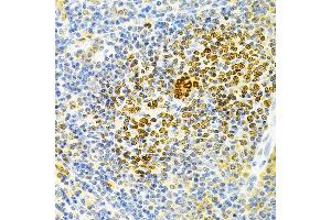 Immunohistochemistry of paraffin-embedded rat spleen using TNFRSF11B Antibody (ABIN3022914, ABIN3022915, ABIN3022916 and ABIN6219293) at dilution of 1:200 (40x lens). (Osteoprotegerin antibody  (AA 22-280))