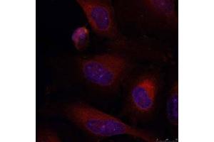 Immunofluorescence staining of methanol-fixed HeLa cells using JunB (Ab-79) antibody (E021026, Red) (JunB antibody)