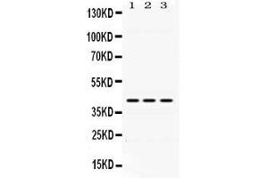 Western blot analysis of DHODH expression in rat liver extract ( Lane 1), mouse spleen extract ( Lane 2) and HEPG2 whole cell lysates ( Lane 3).