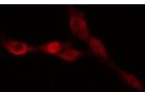 ABIN6274988 staining HepG2 cells by IF/ICC. (CEP170 antibody  (Internal Region))
