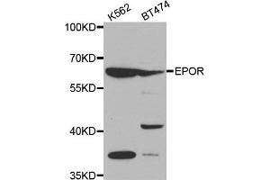 Western blot analysis of extracts of various cell lines, using EPOR antibody. (EPOR antibody  (AA 274-508))