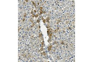 IHC analysis of LIPC using anti-LIPC antibody (ABIN7601582). (LIPC antibody  (AA 39-494))