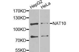 Western blot analysis of extracts of various cells, using NAT10 antibody.