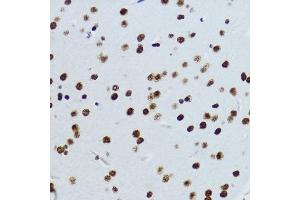 Immunohistochemistry of paraffin-embedded mouse brain using Acetyl-Histone H3-K9 antibody (ABIN7267675) at dilution of 1:200 (40x lens). (Histone 3 antibody  (H3K9))