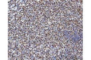 IHC analysis of MFF using anti-MFF antibody (ABIN7599292). (MFF antibody  (AA 1-342))