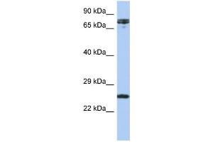 WB Suggested Anti-HNF1A Antibody Titration:  0.