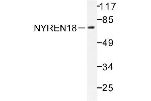 Image no. 1 for anti-Negative Regulator of Ubiquitin-Like Proteins 1 (NUB1) antibody (ABIN271950) (NUB1 antibody)
