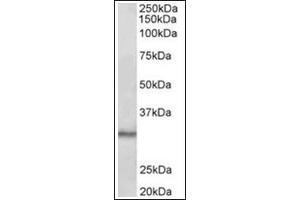 Staining of Mouse Testis lysate (35µg protein in RIPA buffer) using CTDSP1 antibody at 0. (CTDSP1 antibody  (Internal Region))