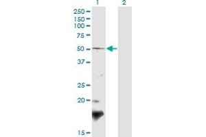 Western Blot analysis of BSCL2 expression in transfected 293T cell line by BSCL2 polyclonal antibody (A02). (BSCL2 antibody  (AA 263-354))