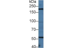 Western blot analysis of Mouse Small intestine lysate, using Mouse LAMb2 Antibody (2 µg/ml) and HRP-conjugated Goat Anti-Rabbit antibody ( (LAMB2 antibody  (AA 1498-1716))