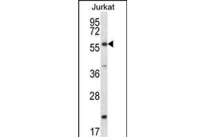 FOXJ3 Antibody (N-term) (ABIN657277 and ABIN2846366) western blot analysis in Jurkat cell line lysates (35 μg/lane). (FOXJ3 antibody  (N-Term))