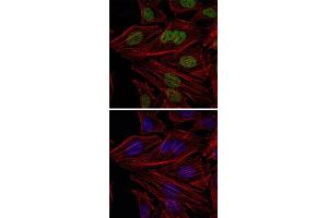 Immunofluorescence analysis of HeLa cells using BMI1 monoclonal antibody, clone 3E3  (green).