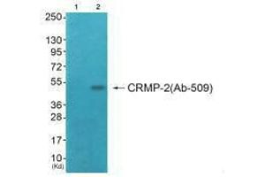 Western blot analysis of extracts from COS7 cells (Lane 2), using CRMP-2 (Ab-509) antiobdy. (DPYSL2 antibody  (Thr509))