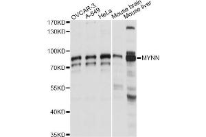 Western blot analysis of extracts of various cell lines, using MYNN antibody (ABIN6291174) at 1:1000 dilution. (Myoneurin antibody)