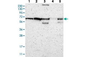 Western blot analysis of Lane 1: RT-4, Lane 2: U-251 MG, Lane 3: Human Plasma, Lane 4: Liver, Lane 5: Tonsil with ME2 polyclonal antibody  at 1:250-1:500 dilution.