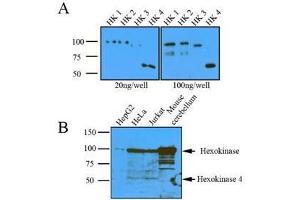 (A): Recombinant protein (20ng or 100ng) of Hexokinase four isoform were resolved by SDS-PAGE, transferred to nitrocellulose membrane and probed with anti-human Hexokinase (1:1000). (Hexokinase antibody  (AA 1-917))