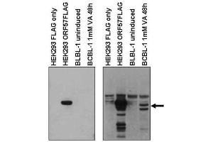 Western blot using  affinity purified anti-KSHV ORF57 to detect KSHV ORF57 in HEK293 cells transfected with ORF57 expression vector and ORF57 truncations, or in KSHV infected B-cell line (BCBL-1) treated with or without valproic acid to induce viral replication (arrow). (KSHV ORF57 (C-Term) antibody)