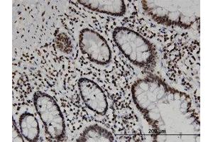 Image no. 1 for anti-CD3e Molecule, epsilon Associated Protein (CD3EAP) (AA 2-111) antibody (ABIN599522) (CD3EAP antibody  (AA 2-111))