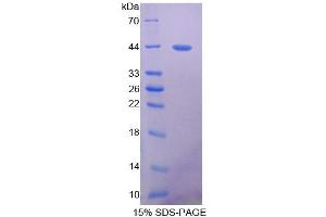 Image no. 1 for Platelet-Derived Growth Factor Receptor-Like (PDGFRL) (AA 22-375) protein (His tag) (ABIN4989631)