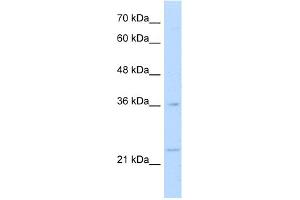 WB Suggested Anti-MAFB Antibody Titration:  1. (MAFB antibody  (N-Term))