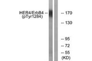 Western blot analysis of extracts from HuvEc cells treated with EGF 200ng/ml 30', using HER4 (Phospho-Tyr1284) Antibody. (ERBB4 antibody  (pTyr1284))