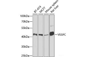 Western blot analysis of extracts of various cell lines using VEGFC Polyclonal Antibody at dilution of 1:500. (VEGFC antibody)