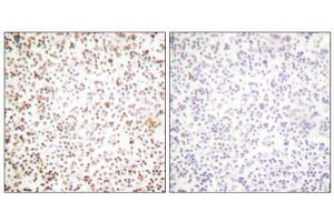 Immunohistochemical analysis of paraffin-embedded human lymph node tissue using OCT-1 antibody (ABIN5976471). (POU2F1 antibody  (N-Term))