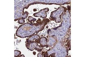 Immunohistochemical staining of human placenta with EID2 polyclonal antibody  shows strong granular cytoplasmic positivity in trophoblastic cells.