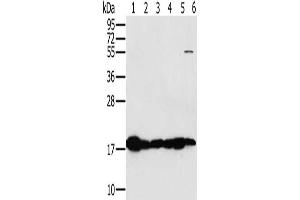 Gel: 10 % SDS-PAGE, Lysate: 40 μg, Lane 1-6: Mouse heart tissue, Mouse muscle tissue, hela cells, mouse liver tissue tissue, mouse kidney tissue, hepg2 cells, Primary antibody: ABIN7130290(MTFP1 Antibody) at dilution 1/450, Secondary antibody: Goat anti rabbit IgG at 1/8000 dilution, Exposure time: 5 seconds (Mtfp1 antibody)