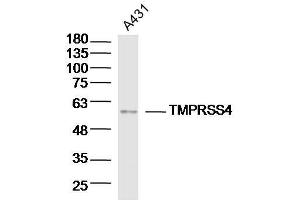 Lane 1: A431 lysates probed with TMPRSS4 Polyclonal Antibody, Unconjugated  at 1:300 overnight at 4˚C. (TMPRSS4 antibody  (AA 84-130))