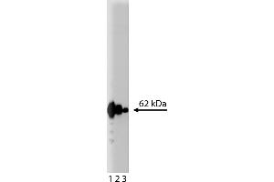 Western Blotting (WB) image for anti-p62 Lck Ligand (AA 257-437) antibody (ABIN968203) (p62 Lck Ligand (AA 257-437) antibody)