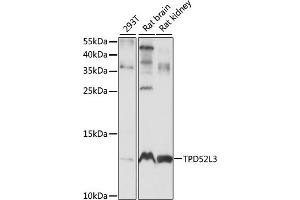Western blot analysis of extracts of various cell lines, using TPD52L3 antibody (ABIN7271078) at 1:1000 dilution. (TPD52L3 antibody  (AA 1-132))