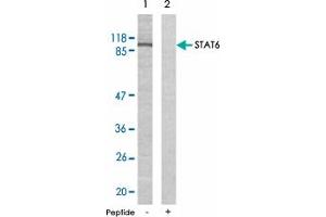 Western blot analysis of extracts from HeLa cells using STAT6 polyclonal antibody . (STAT6 antibody)