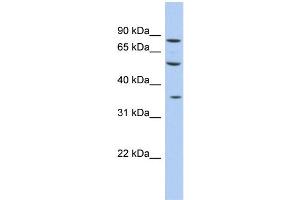WB Suggested Anti-FAM63A Antibody Titration: 0. (FAM63A antibody  (Middle Region))