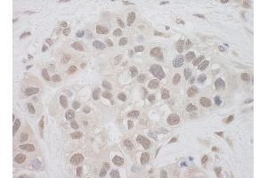 Immunohistochemistry (IHC) image for anti-Suppressor of Ty 7 Like (SUPT7L) (AA 364-414) antibody (ABIN7453797)