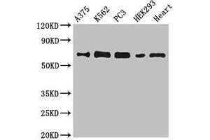 Western Blot Positive WB detected in: A375 whole cell lysate, K562 whole cell lysate, PC-3 whole cell lysate, HEK293 whole cell lysate, Mouse heart tissue All lanes: GBP2 antibody at 6. (GBP2 antibody  (AA 100-259))