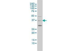PCGF4 monoclonal antibody (M02), clone 4E10-1C5 Western Blot analysis of PCGF4 expression in A-549 . (BMI1 antibody  (AA 1-326))