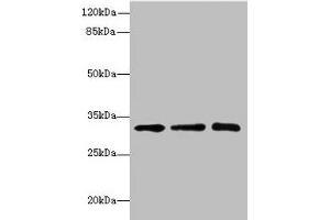 Western blot All lanes: RRAS2 antibody at 4. (SGCD antibody  (AA 60-289))