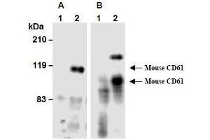 Western Blotting (WB) image for anti-Integrin beta 3 (ITGB3) antibody (ABIN1449278) (Integrin beta 3 antibody)